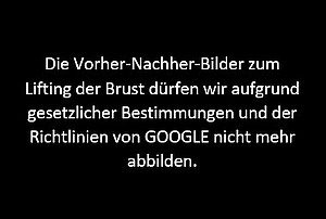 Ersatz Vorher-Nachher-Foto