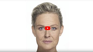 Hautalterung im Zeitraffer