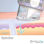 Hydration