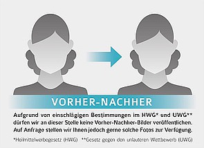 Ersatz Vorher-Nachher-Fotos