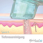 Tiefenreinigung