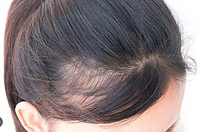 Wirkweise von PhilArt Hair