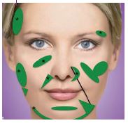 Mit Sculptra behandelbare Areale