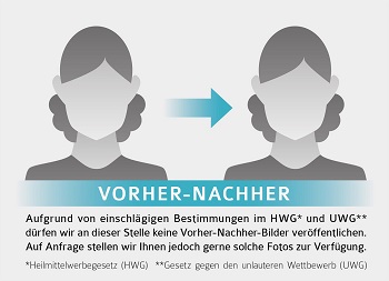 Ersatz Vorher-Nachhher-Fotos