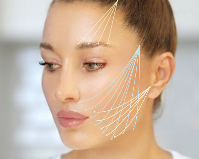 Anti-Aging Behandlung mit Faden-Lifting